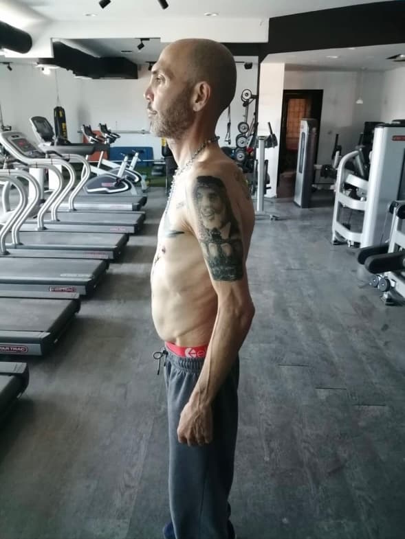 Before: limited mobility due to chronic pain