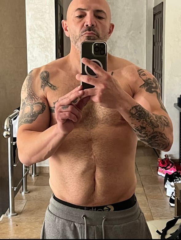 After: full range of motion with pain-free movement